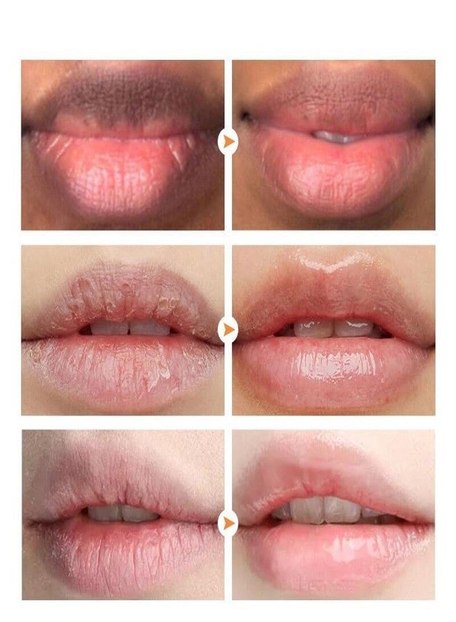 MSECVOI 2PCS Lip Lightening for Dark Lips Lip for Smokers Dark Lip Treatment Lightening Cream for Pink Lips Lip Lightener for Smoker Lips Lip Lightening balm for Men and Women (Pink) - Image 4